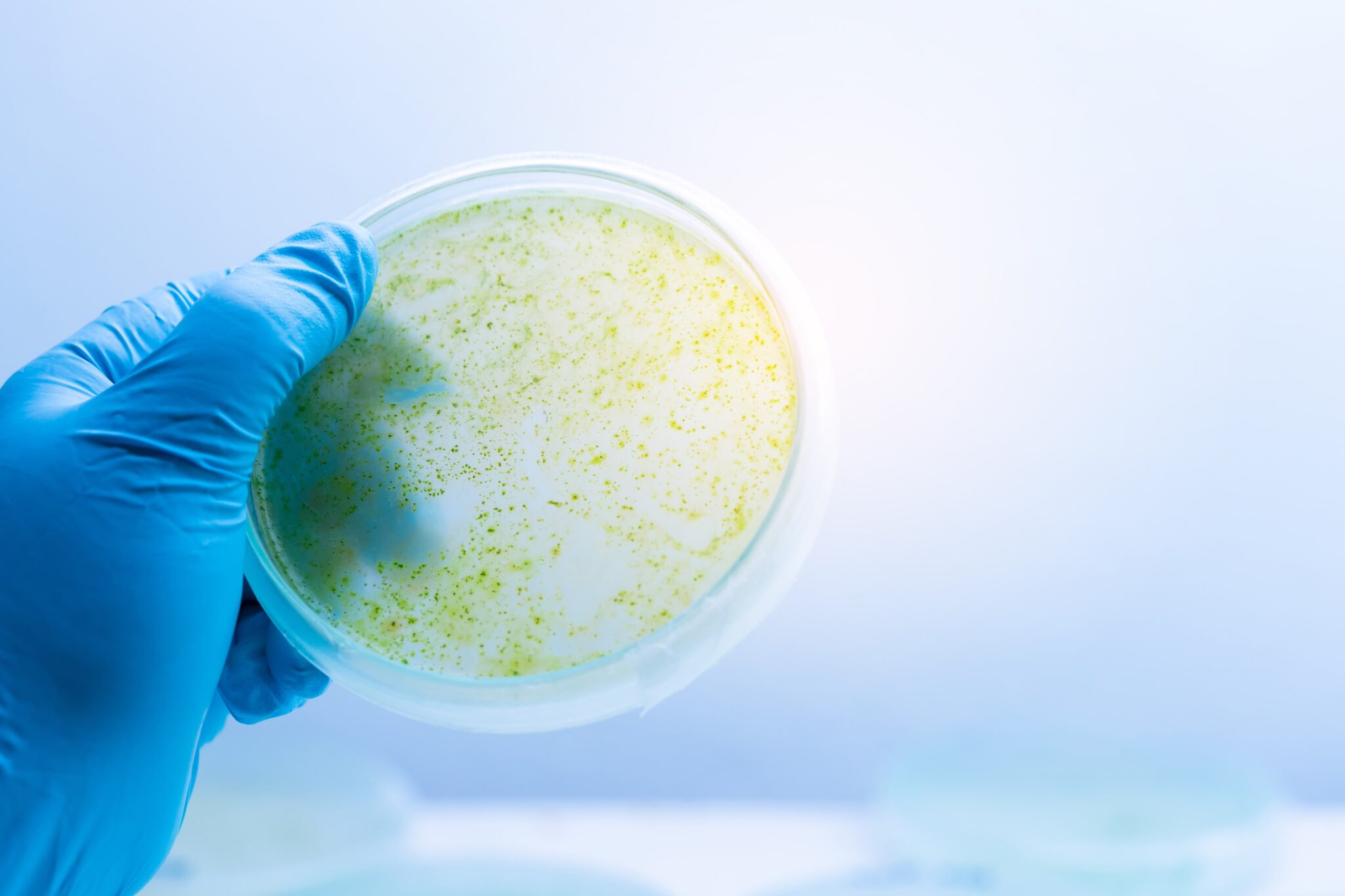 Microbiologicos Análisis en Alimentos – La plataforma avanzada de IA para la gestión ...